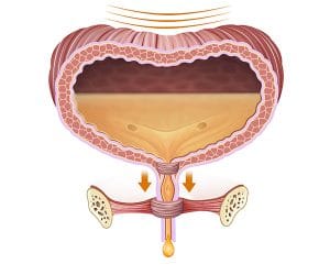 de blaas in het lichaam bij incontinentie 300x250