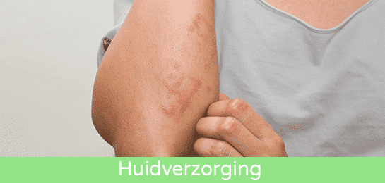 Abena huidverzorging rode huid