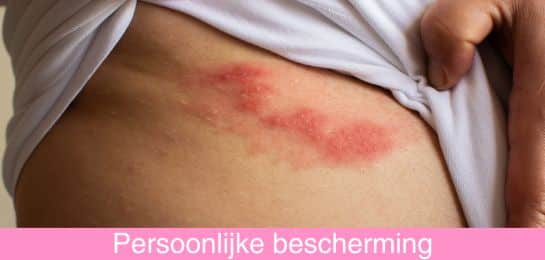 Gordelroos wat is het symptomen en behandeling Abena Healthcare