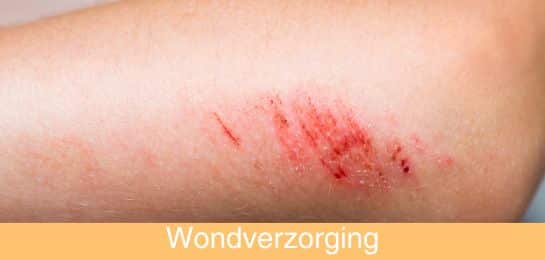 Hoe behandel je een schaafwond ABENA